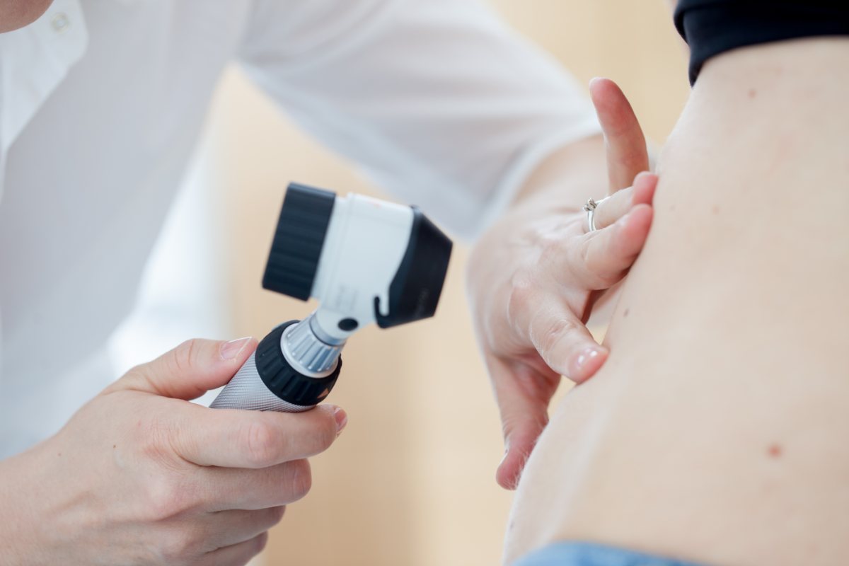 Visita dermatologica