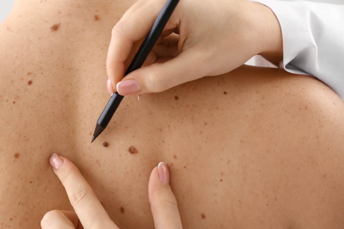 Visita dermatologica